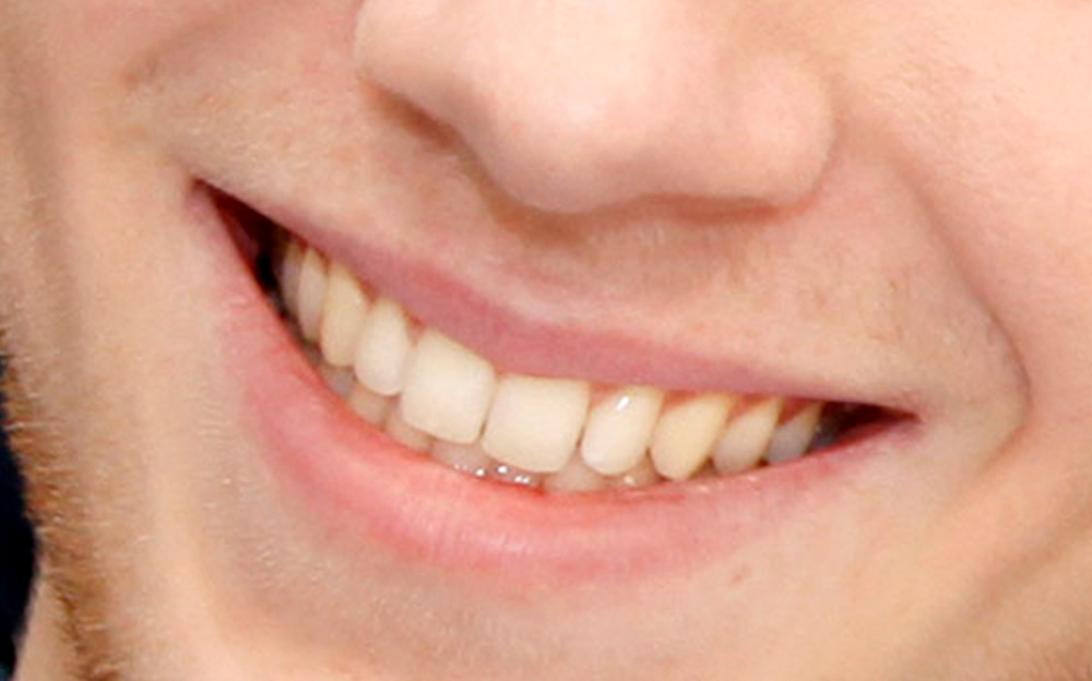 Zahnaesthetik Zahnmedizin - Zahnarzt Aller-Leine-Tal
